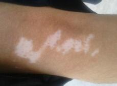 ����ͼƬ