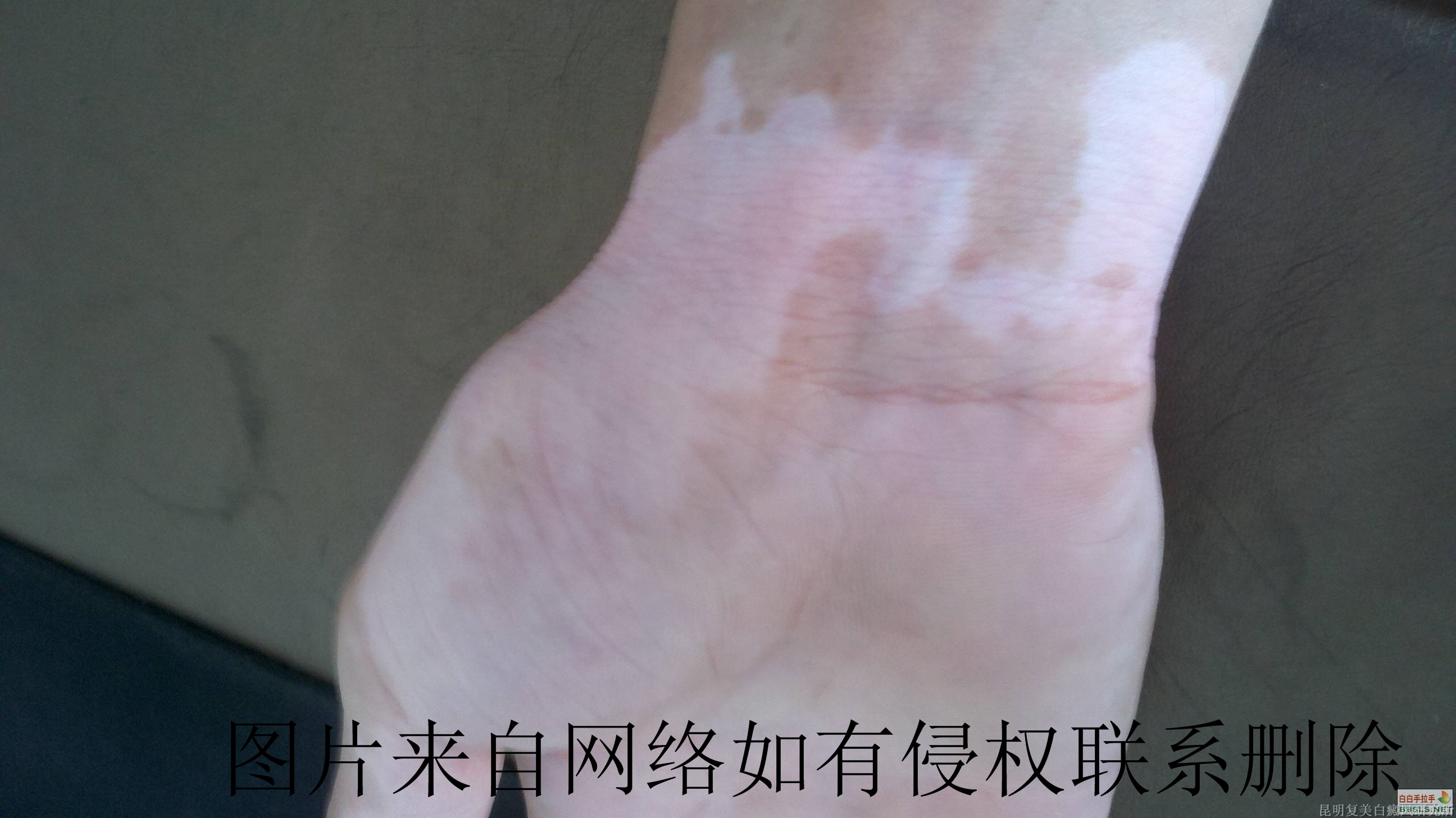 ���综����ʳӦ�ö�ע��ʲô
